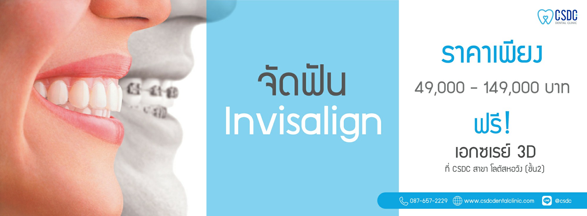 Invisalign-web new